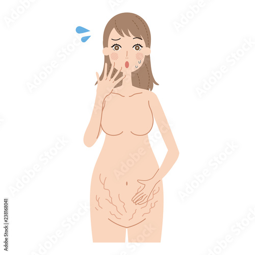 妊娠線にショックを受ける妊婦