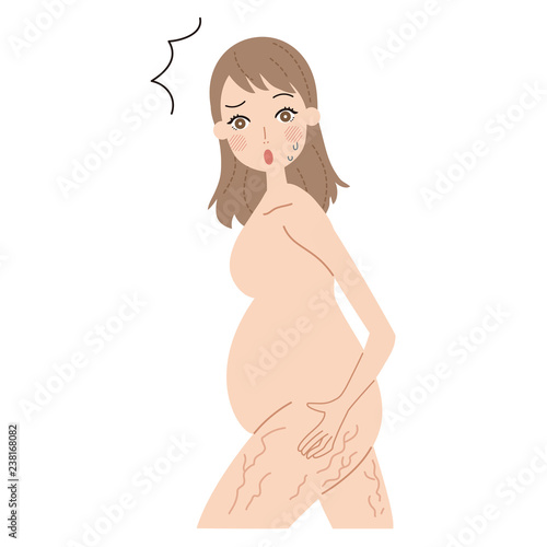 妊娠線にショックを受ける妊婦