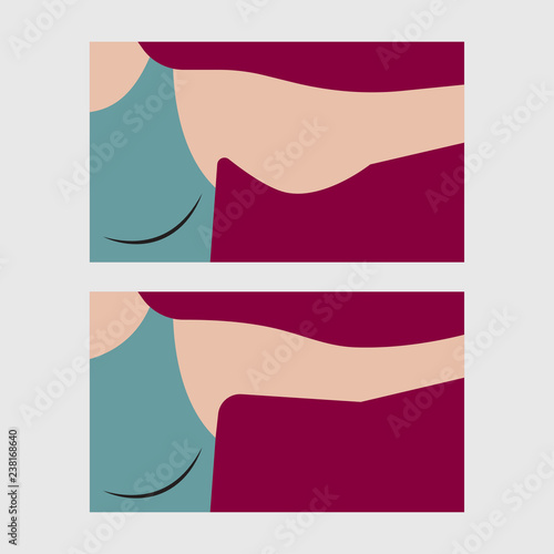 Forearm liposuction, plastic surgery arm lift