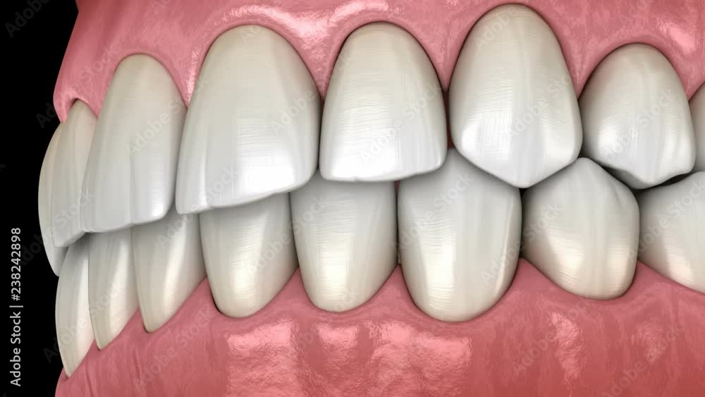 Healthy human teeth with normal occlusion, side view. Medically ...