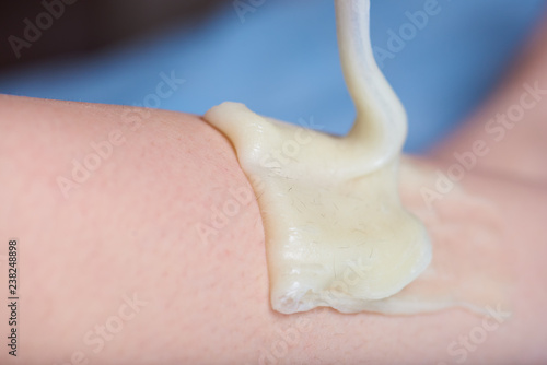 Sugar wax with hair on a leg in a process of sugaring depilation