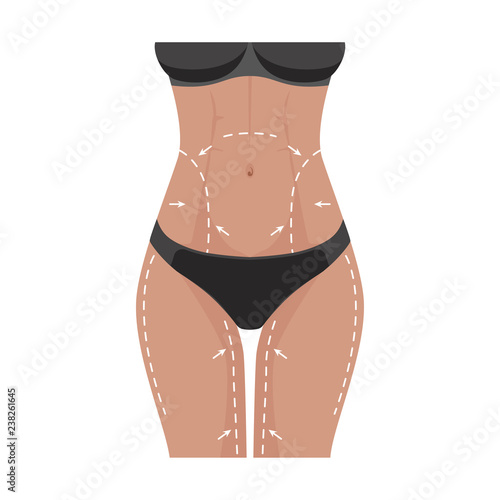 Plastic Surgery Concept. Female Body With Marks On White Background Stock  Photo, Picture and Royalty Free Image. Image 91108971.