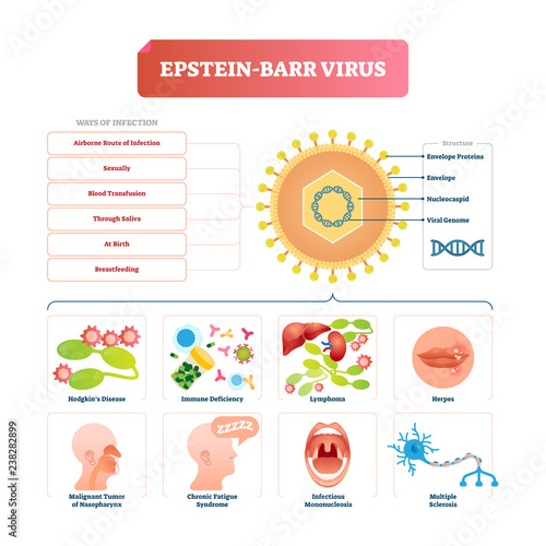 Epstein barr virus vector illustration. Labeled herpes disease explanation. photo