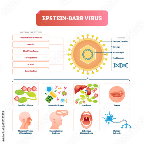 Epstein barr virus vector illustration. Labeled herpes disease explanation.