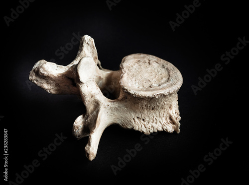 фотографія Vertebra human bone close up isolated on black background
