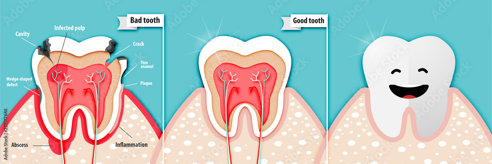 Paper art of health science about bad tooth and good tooth vector