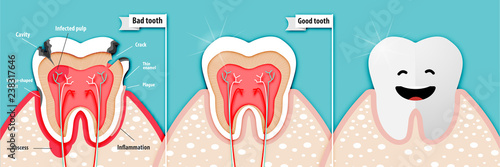 Paper art of health science about bad tooth and good tooth vector
