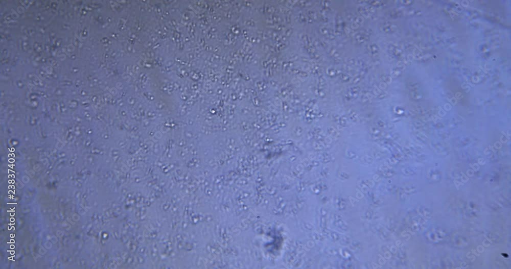 chaotic motion of unicellular cells under a microscope chaotic motion of unicellular cells under a microscope