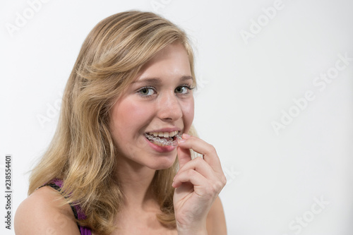 Junge Frau setzt Zahnspange ein