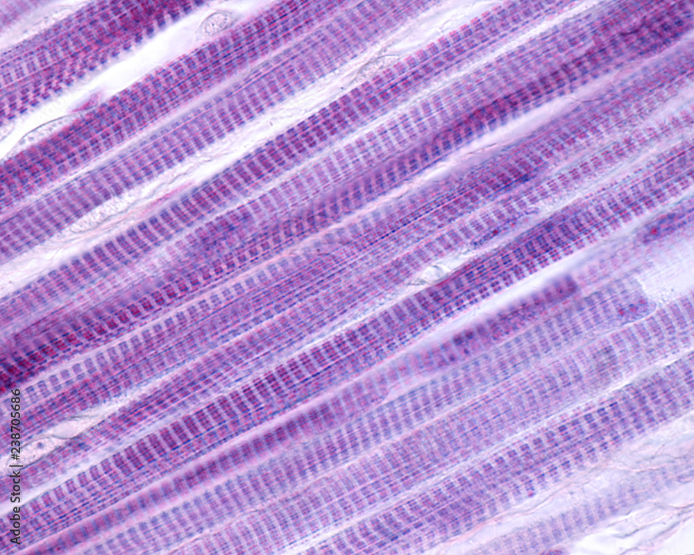 Striated muscle fibers Striated muscle fibers