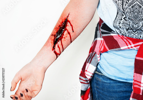 Cut Wound Blood On Hand Cut Sutsyd Vein Professional Makeup Flows Blood Stock Photo Adobe Stock