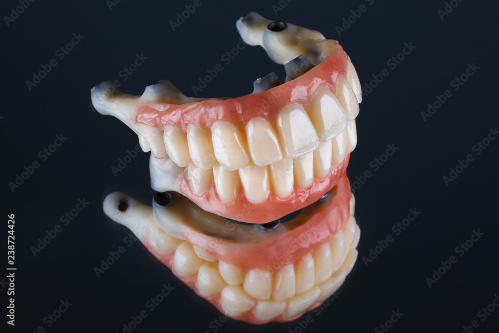 high quality Dental prostheses on the mirror high quality Dental prostheses on the mirror