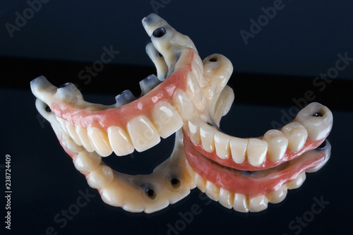 Dental prostheses from ceramics for orthopedics