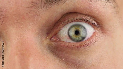 closed left human eye suddenly wide opens, pupils constrict, closeup 
