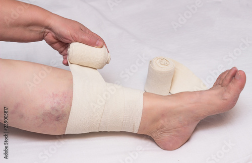 Woman bandages leg with elastic bandage against varicose veins on legs and thrombosis, close-up, white background, phlebeurysm, medical, trauma photo