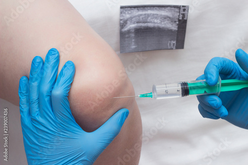 A doctor injects a medical injection of chondroprotector and hyaluronic acid into the knee of a woman to restore the knee joint, cartilage and synovial fluid, close-up photo