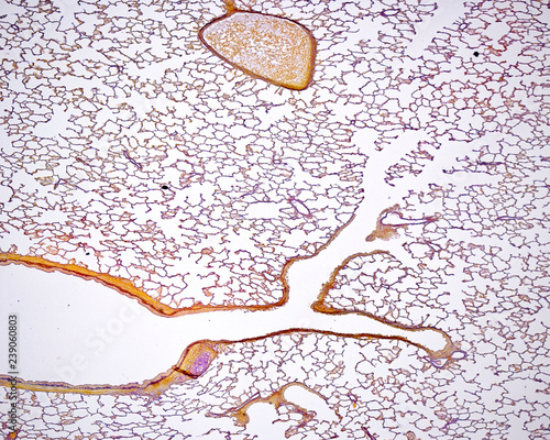 Respiratory tract. Intrapulmonary airways photo