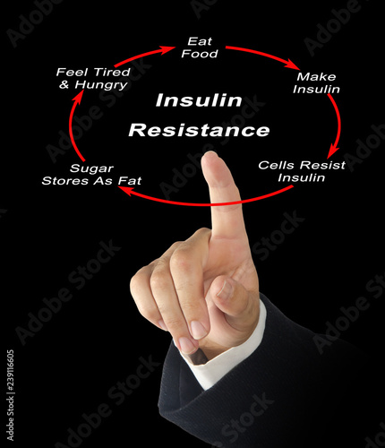 Development of Insulin Resistance