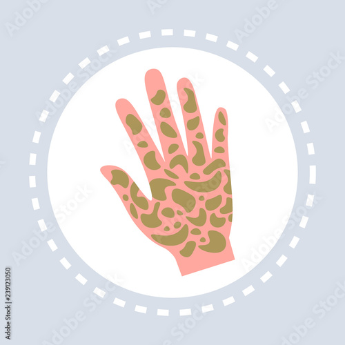 psoriasis shin disease human palm icon healthcare medical service logo medicine and health symbol concept flat