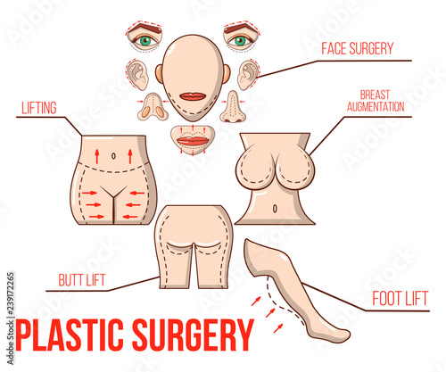 Plastic surgery concept banner. Cartoon banner of plastic surgery vector concept for web, giftcard and postcard