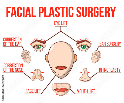 Facial plastic surgery concept banner. Cartoon banner of facial plastic surgery vector concept for web, giftcard and postcard