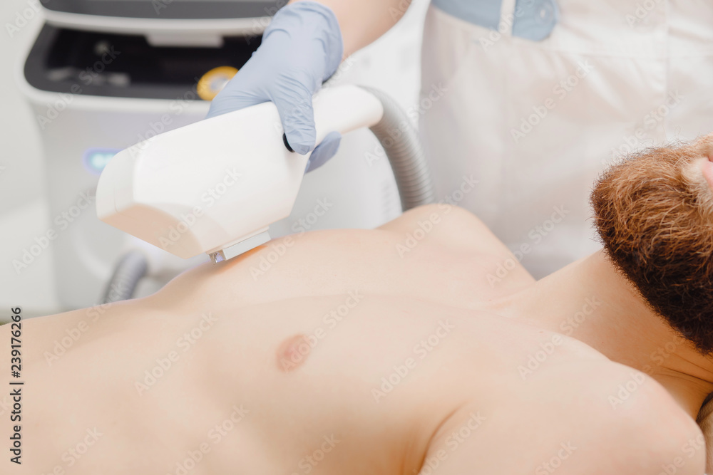 Laser hair removal of man breast. Close up. Concept beauty, self-care and  body Stock Photo | Adobe Stock
