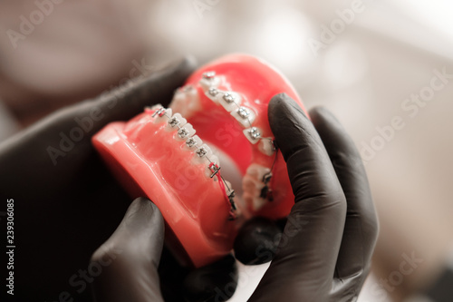 Dentist in black gloves holding Dental casting model human Jaws with braces in prosthetic laboratory. Dentistry, Orthodontics. Close up. selective focus photo