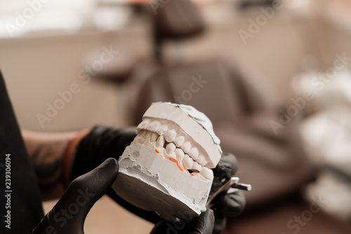 Plaster Cast of jaws. Dentist in black gloves holding Dental casting gypsum model human Jaws in prosthetic laboratory. Dentistry, Orthodontics. Close up. selective focus photo