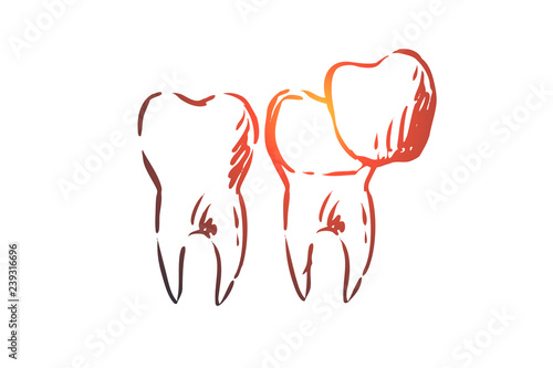 Veneer, dental, care, dentistry, whitening concept. Hand drawn isolated vector.