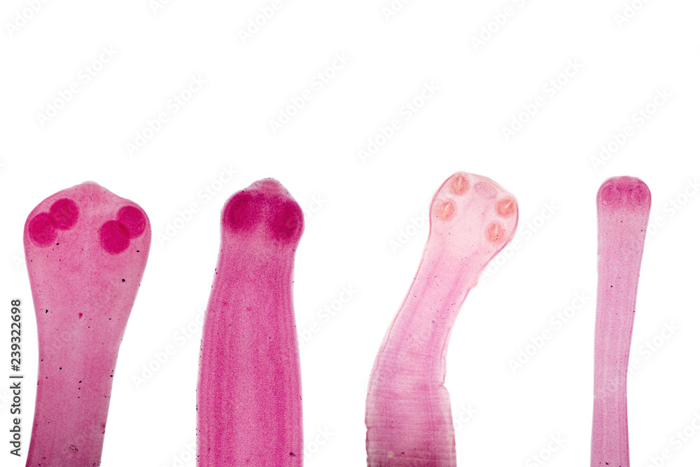 Patterns and backgrounds of Parasitic, Study for Anatomical pathology