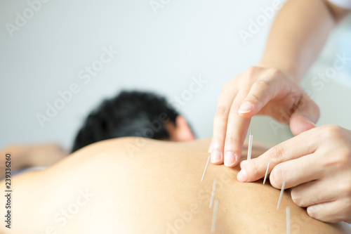 traditional acupuncture treatment