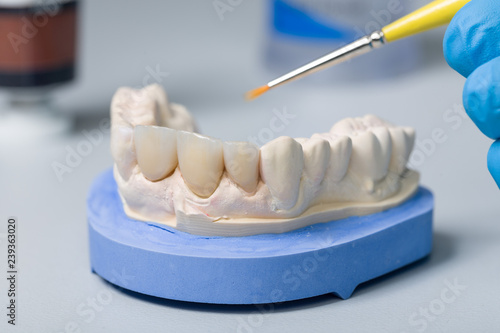 Zahnersatz auf Abdruck mit Pinsel im Zahnlabor