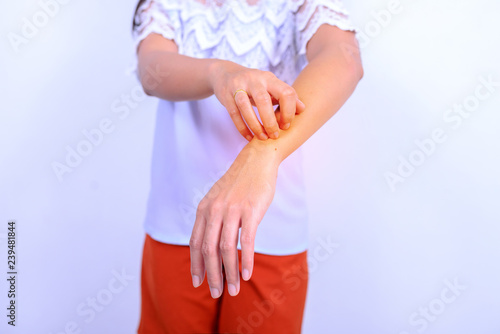 Wallpaper Mural Signs and symptoms of left arm itching and scratch the arm. Torontodigital.ca