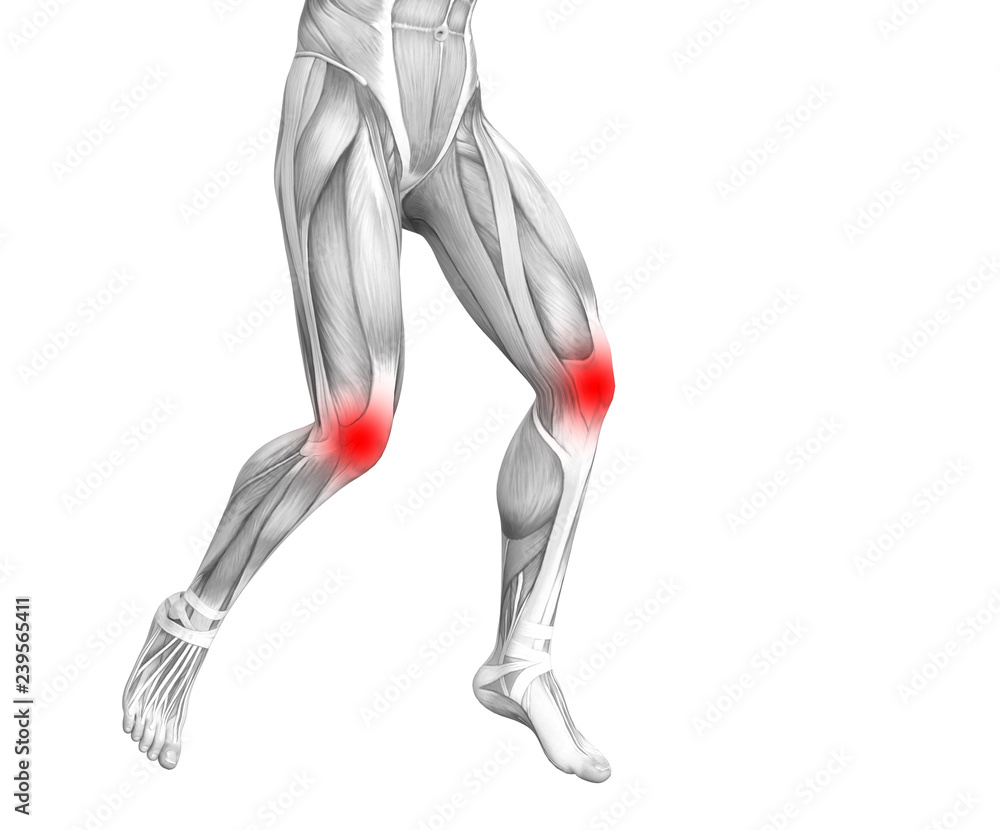 Conceptual knee human anatomy with red hot spot inflammation or articular joint pain for leg health care therapy or sport muscle concepts. 3D illustration man arthritis or bone osteoporosis disease Conceptual knee human anatomy with red hot spot inflammation or articular joint pain for leg health care therapy or sport muscle concepts. 3D illustration man arthritis or bone osteoporosis disease