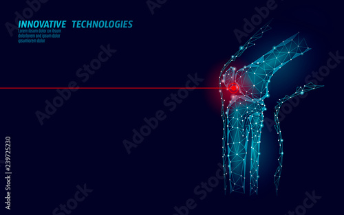 Human knee joint 3d model vector illustration. Low poly design future technology cure pain treatment. Blue background and red injury man body leg medicine template photo