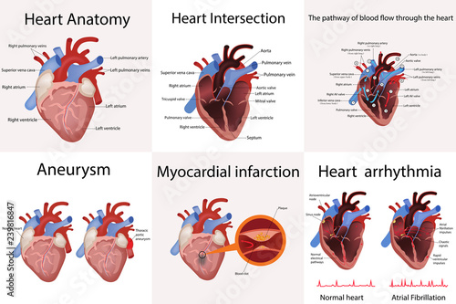 heart anatomy and types of heart disease vector illustration photo