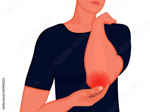 Vector illustration of a pain in an elbow joint. A human is holding his elbow. Front view. For advertising and medical publications