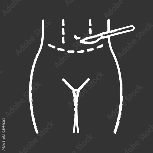 Tummy tuck plastic chalk icon