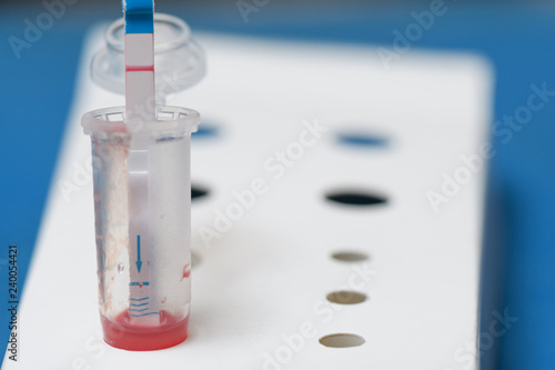 Foto Express used HIV test using blood from a finger macro
