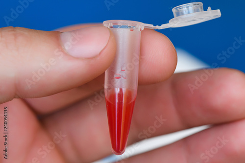 plastic beaker with reagent and blood for disease test photo