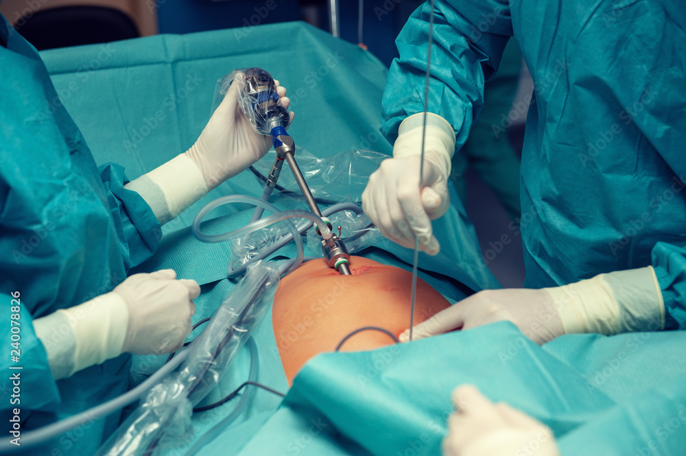 Surgeons working on a patient Surgeons working on a patient