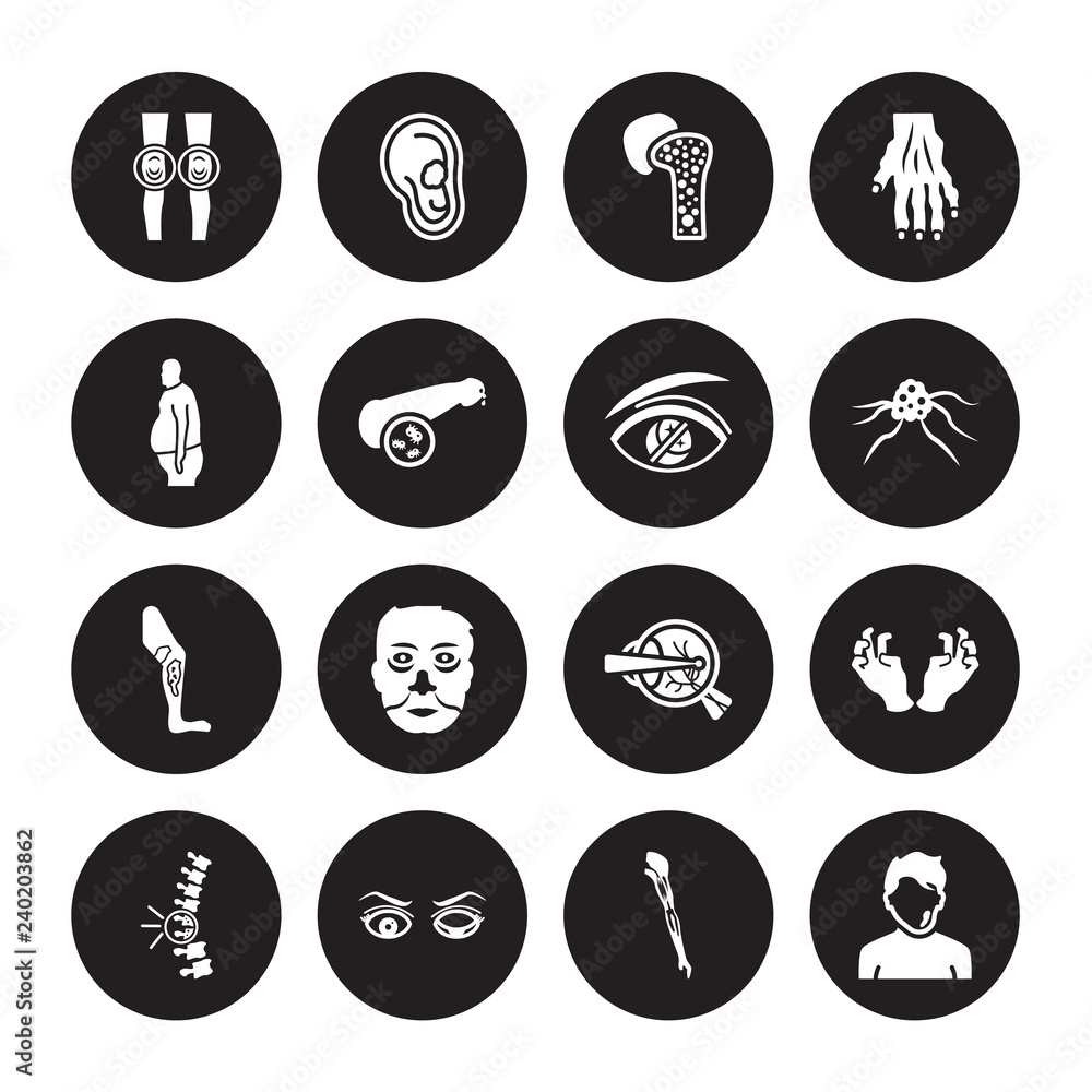 16 vector icon set : Myxedema, Mí©niíÂre's disease, Microcephaly, Middle East Respiratory Syndrome (MERS), Migraine isolated on black background 16 vector icon set : Myxedema, Mí©niíÂre's disease, Microcephaly, Middle East Respiratory Syndrome (MERS), Migraine isolated on black background