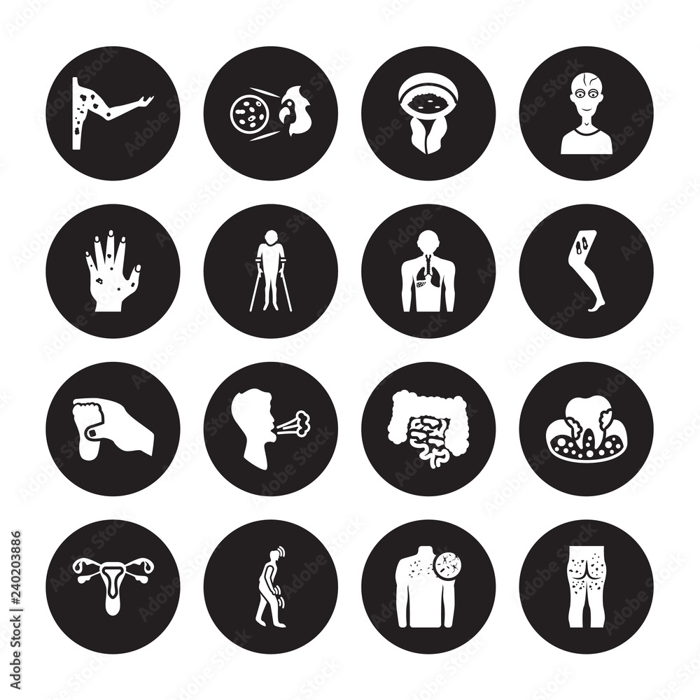 16 vector icon set : Peritonitis, Neoplasm, Night blindness, Non-gonococcal urethritis, Obesity, Necrotizing Fasciitis, Paratyphoid fever, Otitis, Palindromic rheumatism isolated on black background