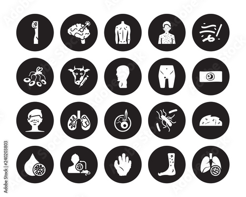 20 vector icon set : Lymphoma, Kuru, Kwashiorkor, Laryngitis, Lead poisoning, Lupus, Limbtoosa, Leprosy, Leukemia, Loiasis, Lyme disease isolated on black background