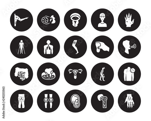 20 vector icon set : Peritonitis, Myoclonus, Myopia, Myxedema, Necrotizing Fasciitis, Paratyphoid fever, Otitis, Non-gonococcal urethritis, Osteoarthritis isolated on black background