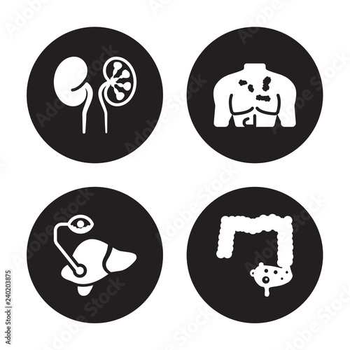 4 vector icon set : Iron-deficiency anemia, Interstitial cystitis, Iritis, Influenza isolated on black background