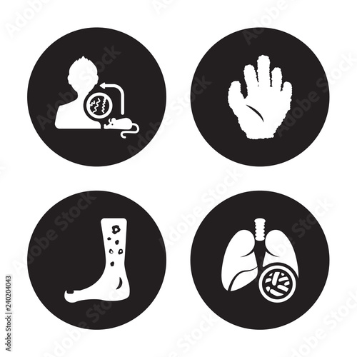 4 vector icon set : Laryngitis, Kuru, Kwashiorkor, Kidney stone disease isolated on black background