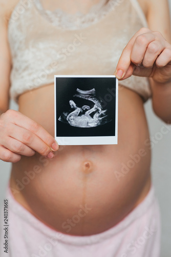 photo ultrasound in the hands of a pregnant girl on a belly background