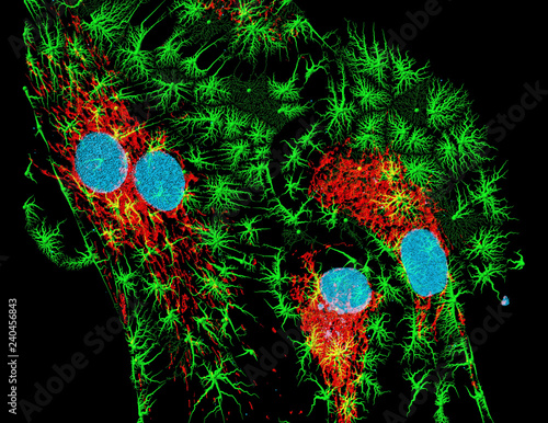 Εκτύπωση καμβά Fibroblasts