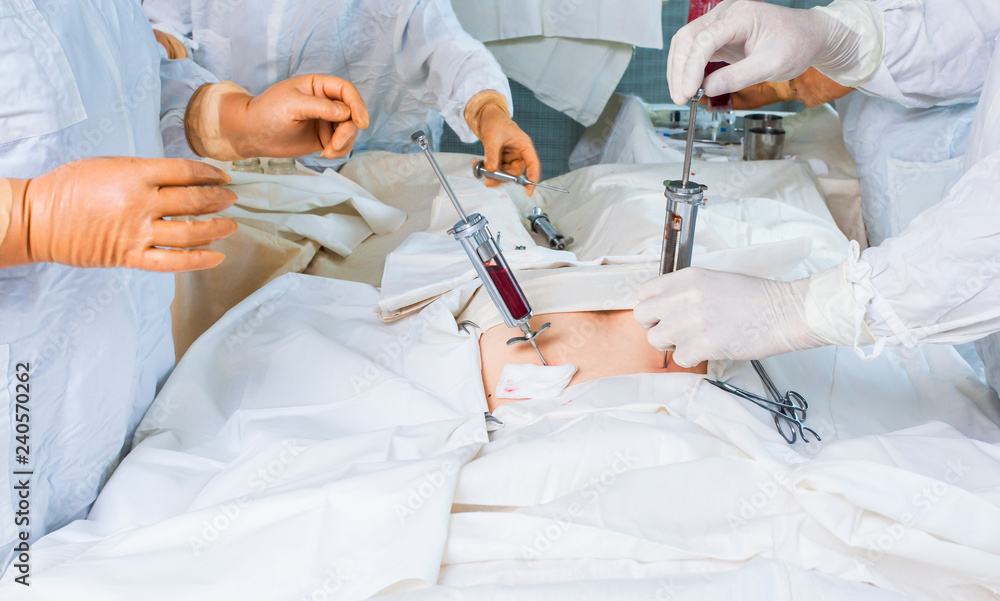 Фотография bone marrow transplant operation